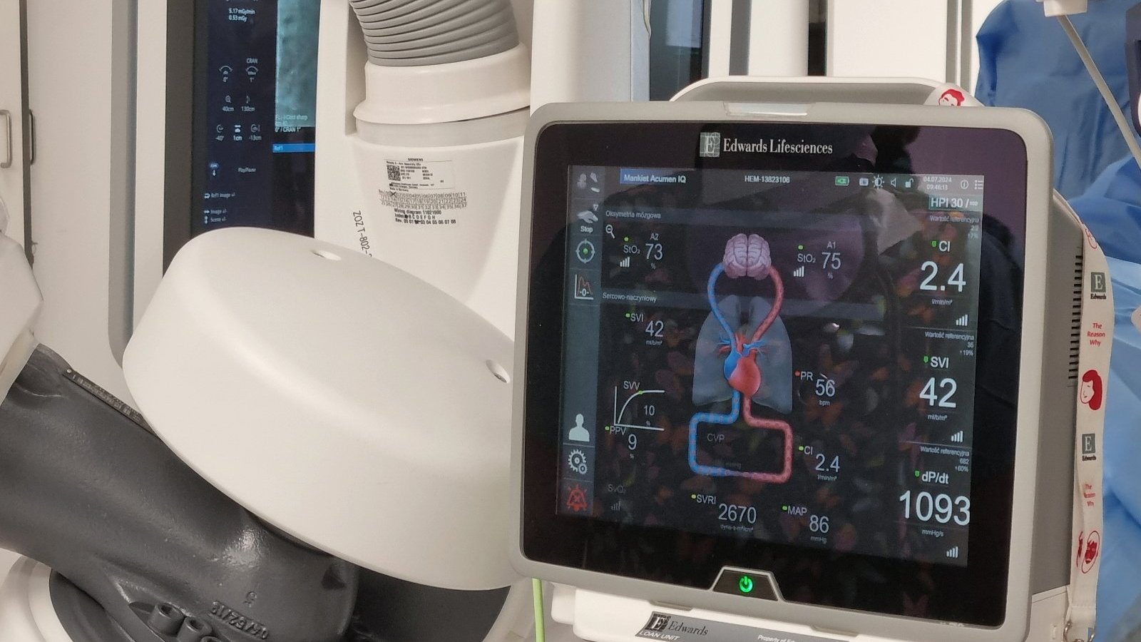 Zdjęcie przedstawia monitor na sali operacyjnej.