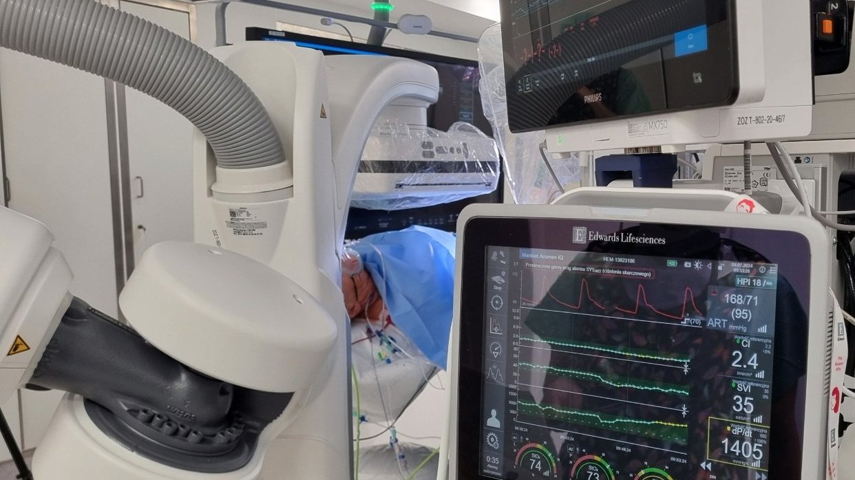 Zdjęcie przedstawia monitor badający parametry pacjenta.